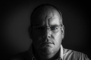 Hard Skin Warts on Stomach: Causes and Remedies 39 Hard Skin Warts on Stomach: Causes and Remedies