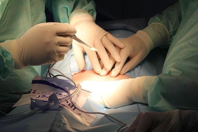 Understanding Surgical Procedures for Removal