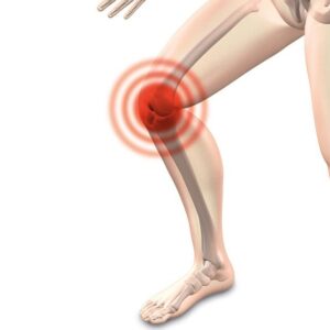 Knee Warts Photos: Visual Documentation of Various Knee Warts